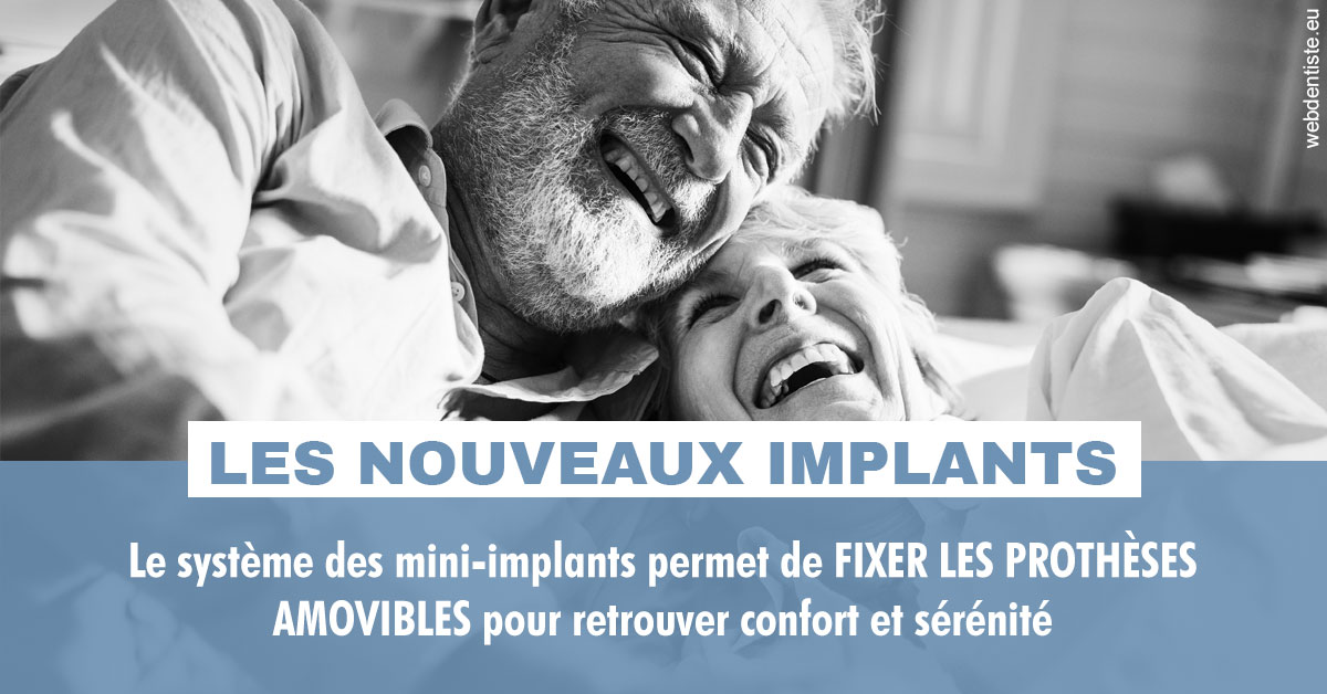 https://www.dr-renard-orthodontiste.fr/Les nouveaux implants 2