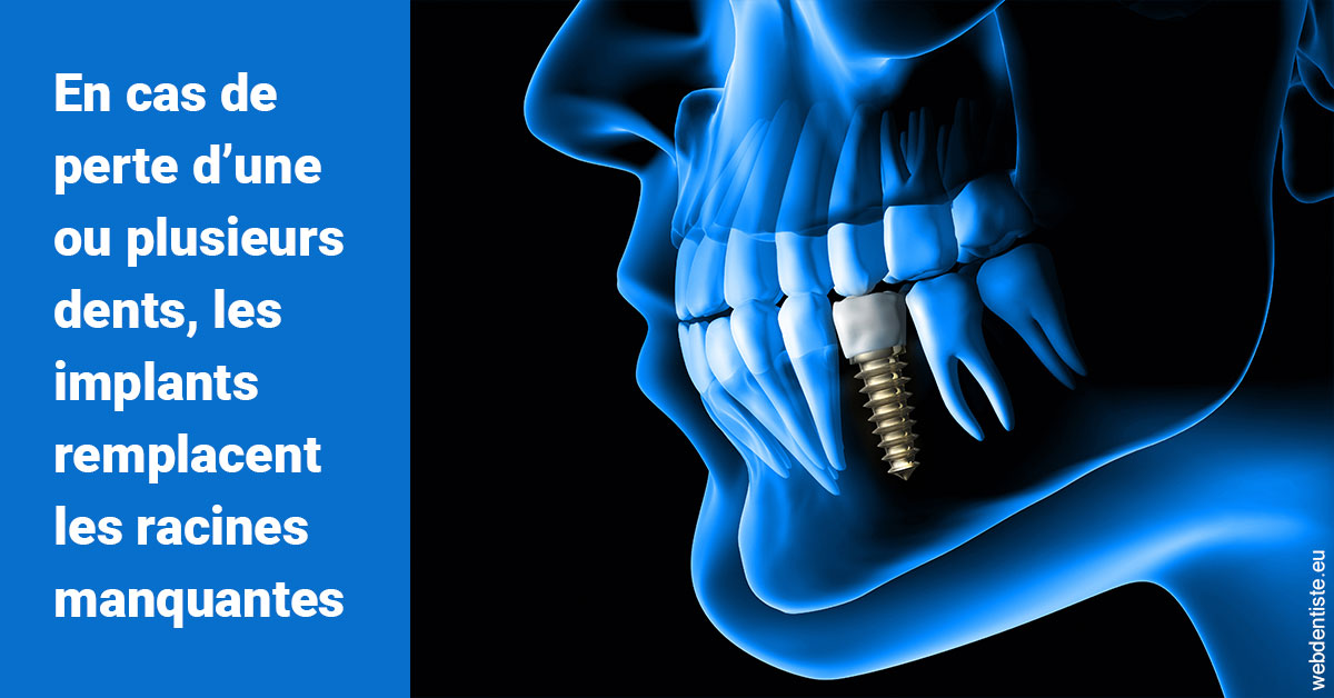 https://www.dr-renard-orthodontiste.fr/Les implants 1