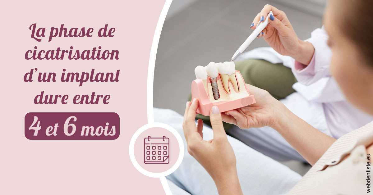 https://www.dr-renard-orthodontiste.fr/Cicatrisation implant 2