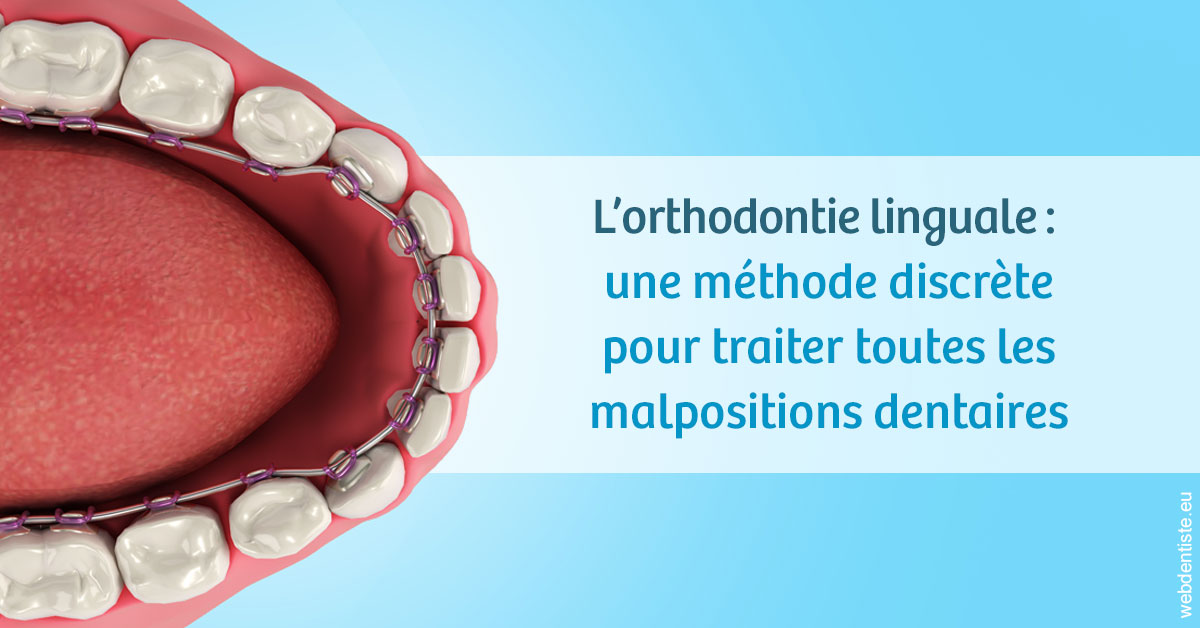 https://www.dr-renard-orthodontiste.fr/L'orthodontie linguale 1