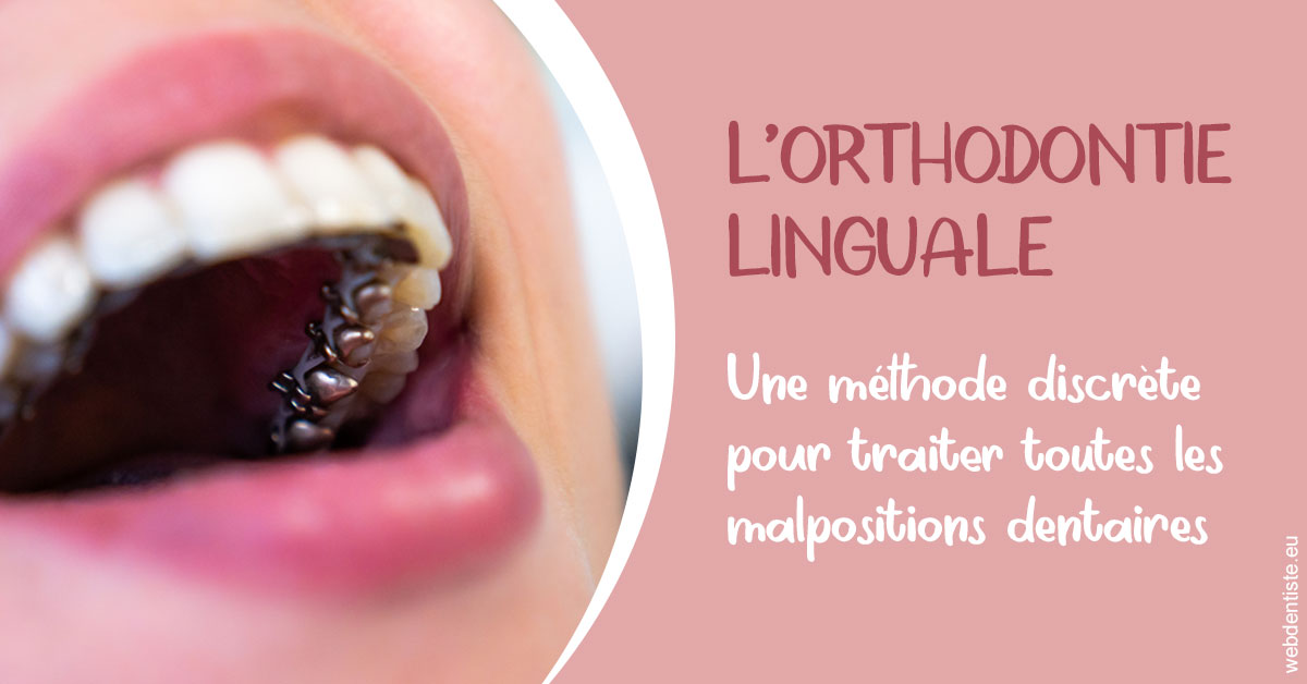 https://www.dr-renard-orthodontiste.fr/L'orthodontie linguale 2