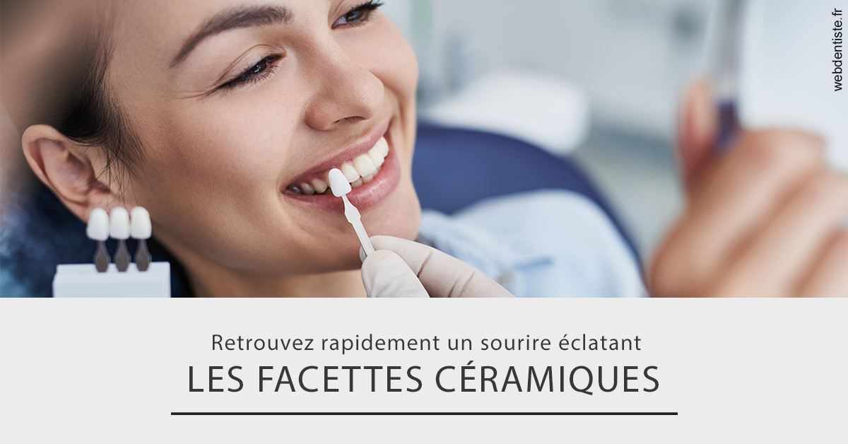 https://www.dr-renard-orthodontiste.fr/Les facettes céramiques 2