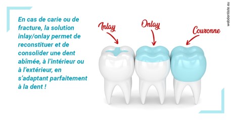 https://www.dr-renard-orthodontiste.fr/L'INLAY ou l'ONLAY