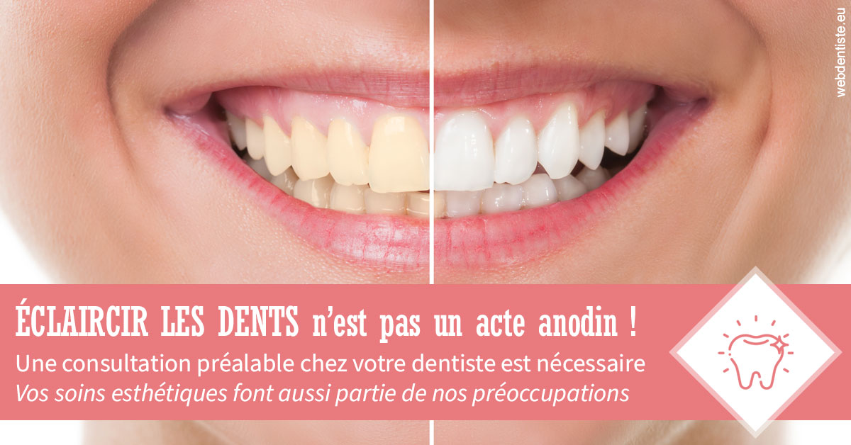 https://www.dr-renard-orthodontiste.fr/Eclaircir les dents 1