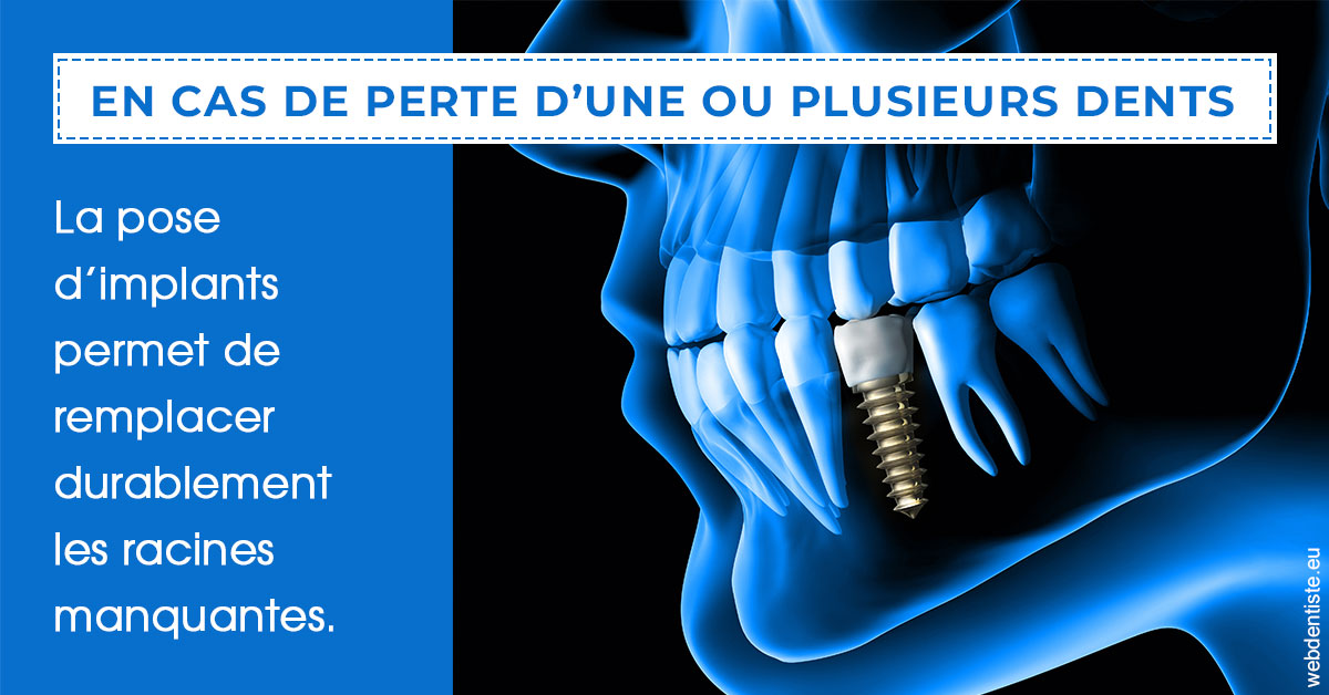 https://www.dr-renard-orthodontiste.fr/2024 T1 - Implants 01