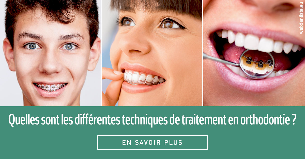 https://www.dr-renard-orthodontiste.fr/Les différentes techniques de traitement 2