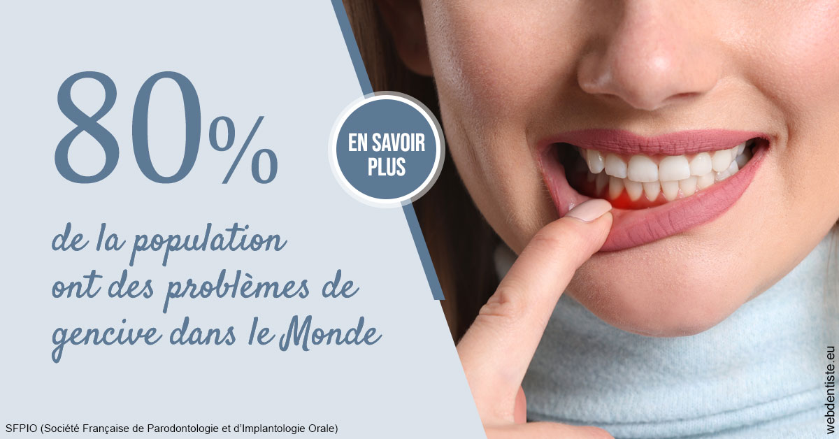 https://www.dr-renard-orthodontiste.fr/Problèmes de gencive 2