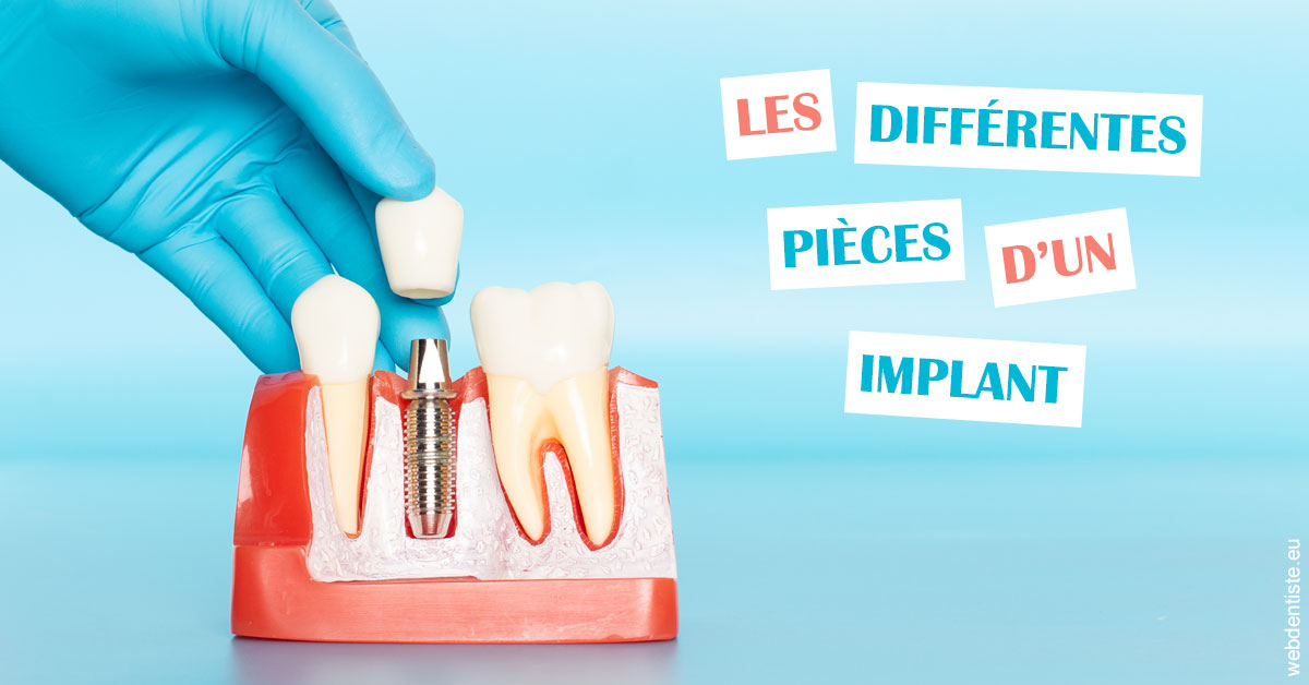 https://www.dr-renard-orthodontiste.fr/Les différentes pièces d’un implant 2