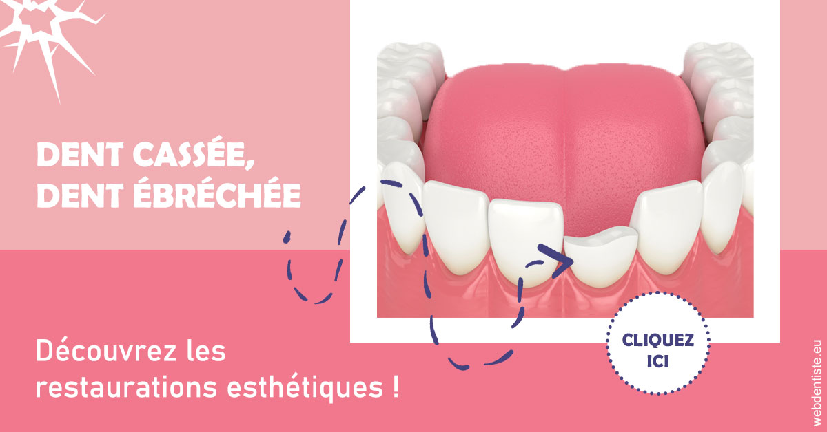 https://www.dr-renard-orthodontiste.fr/Dent cassée ébréchée 1