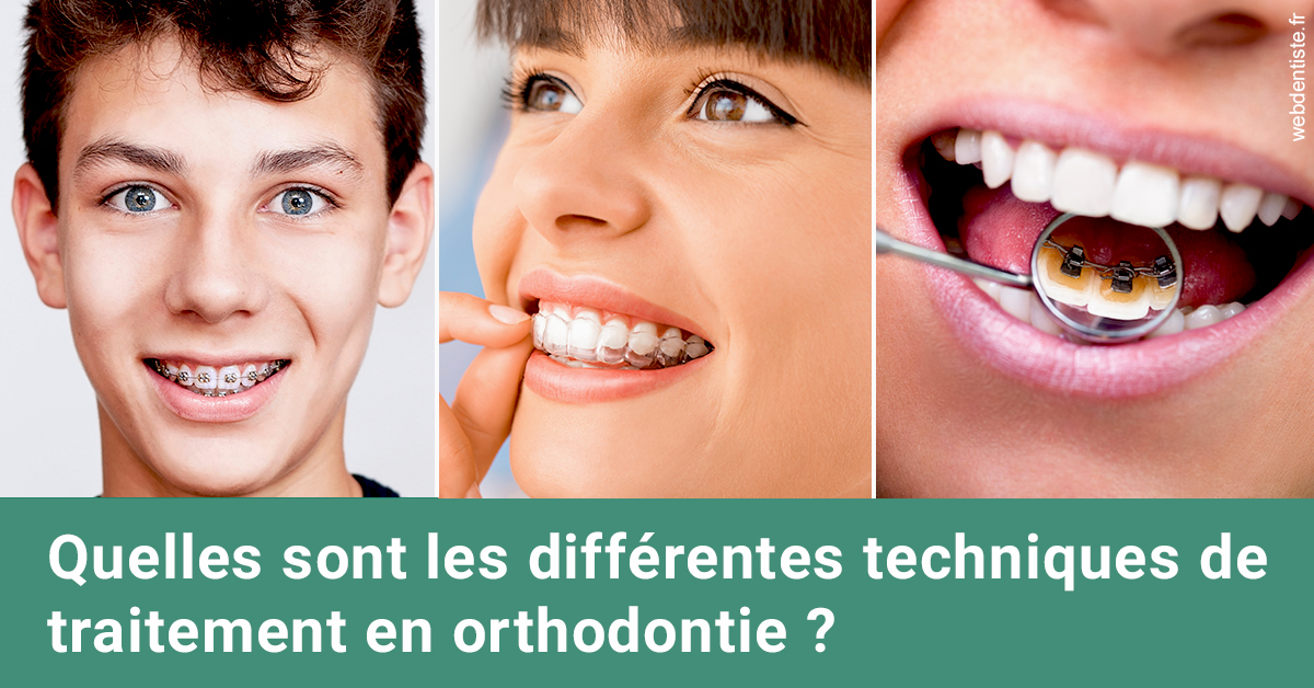 https://www.dr-renard-orthodontiste.fr/Les différentes techniques de traitement 2
