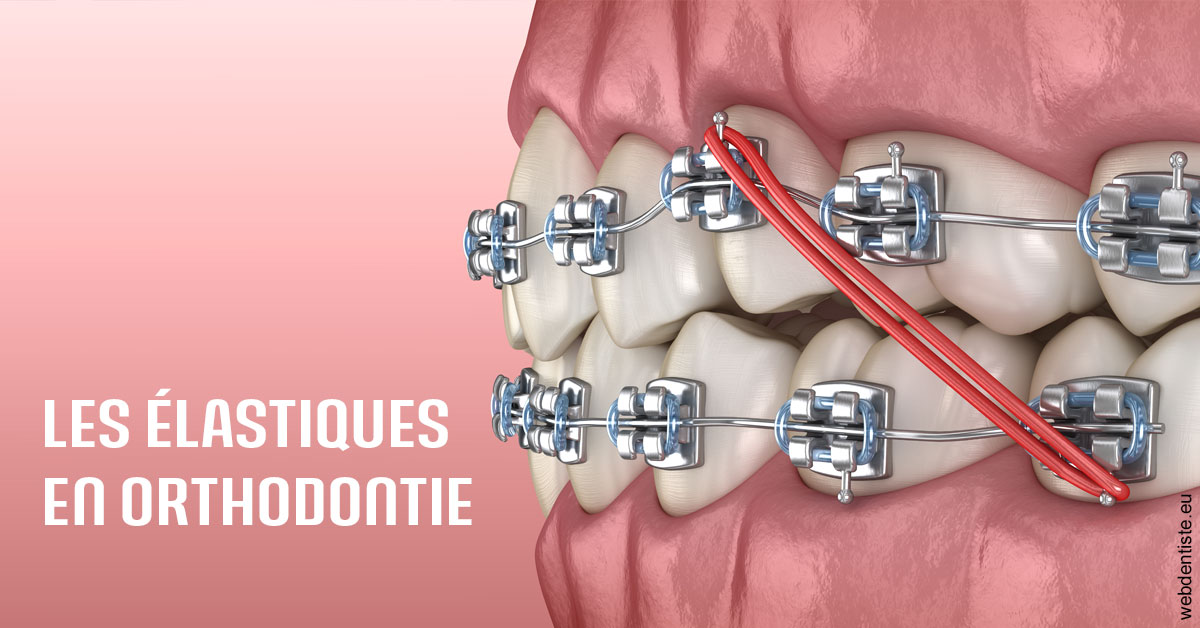 https://www.dr-renard-orthodontiste.fr/Elastiques orthodontie 2