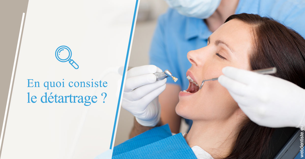 https://www.dr-renard-orthodontiste.fr/En quoi consiste le détartrage