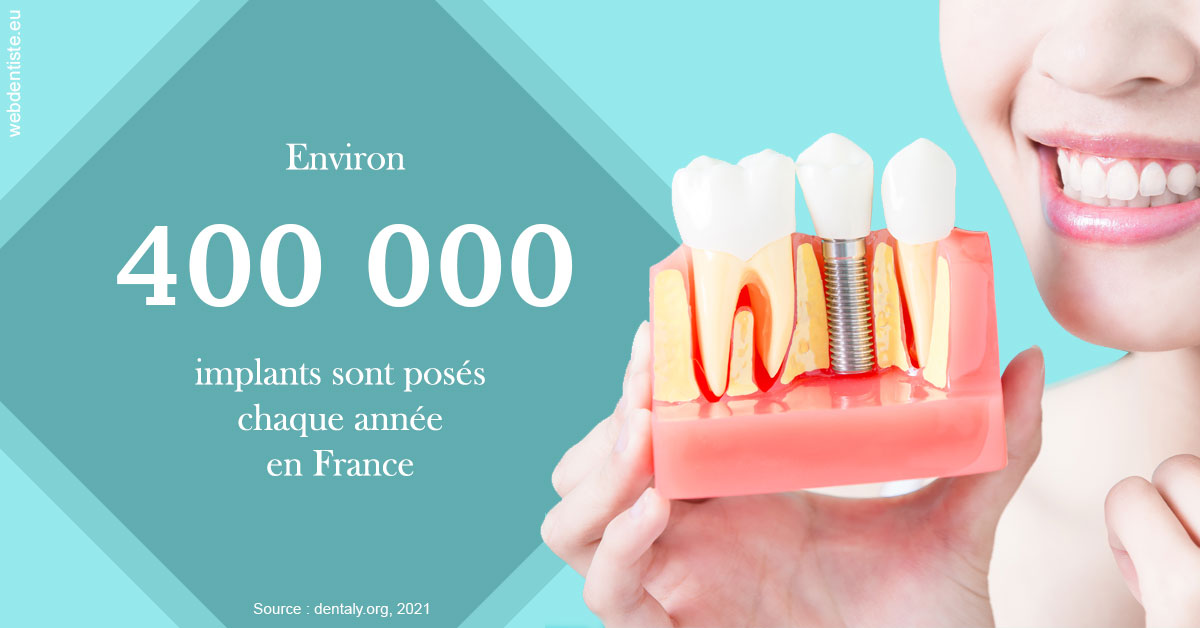 https://www.dr-renard-orthodontiste.fr/Pose d'implants en France 2