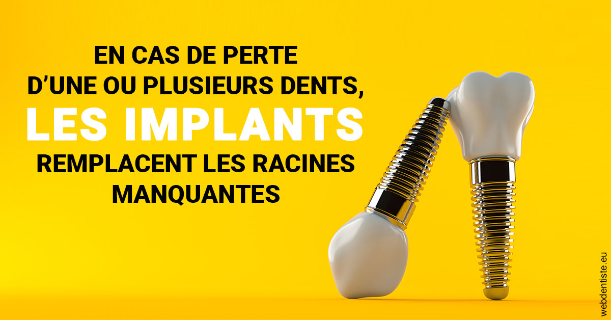 https://www.dr-renard-orthodontiste.fr/Les implants 2
